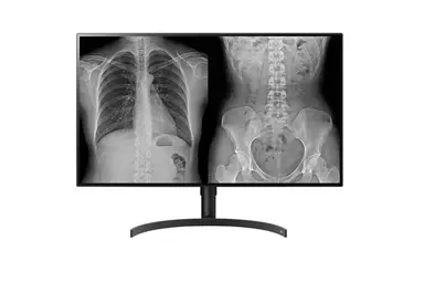 LG Electronics USA LG - LCD Monitor - Flat - 3840 × 2160 - 31.5 in - 5MS Response Time, image 4