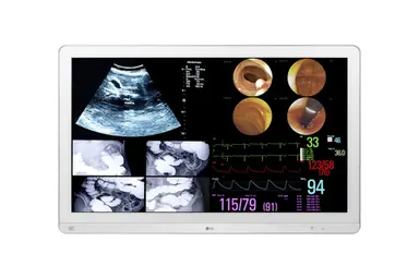 LG Electronics USA 32 in LG Medical IPS 4K Surgical Monitor, 3480 × 2160, HDMI DP USB, HDR10 Dicom H, image 4